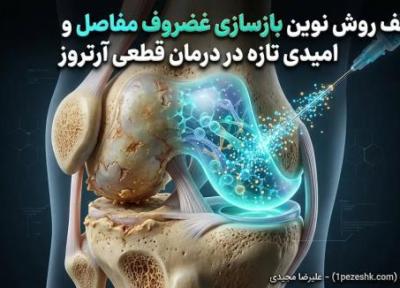 کشف روش نوین بازسازی غضروف مفاصل و امیدی تازه در درمان قطعی آرتروز کشف روش نوین بازسازی غضروف مفاصل و امیدی تازه در درمان قطعی آرتروز